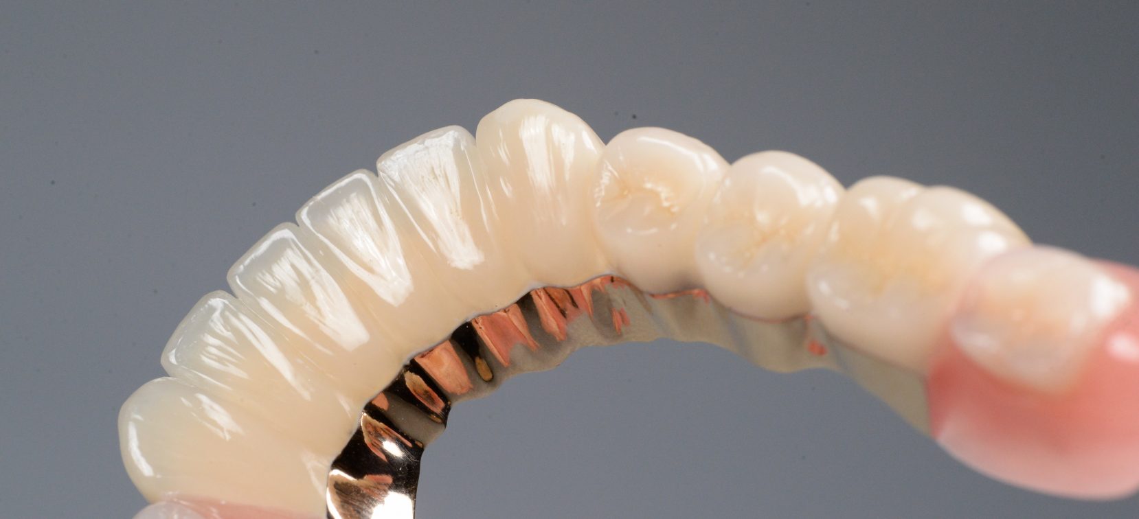 奥歯が4本ない場合の治療方法について